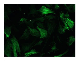 Unanalyzed image of acting fibers